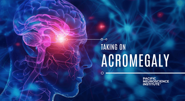 Taking on Acromegaly at Pacific Neuroscience Institute