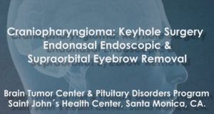 Endoscopic Endonasal Procedure Videos - Pacific Neuroscience Institute